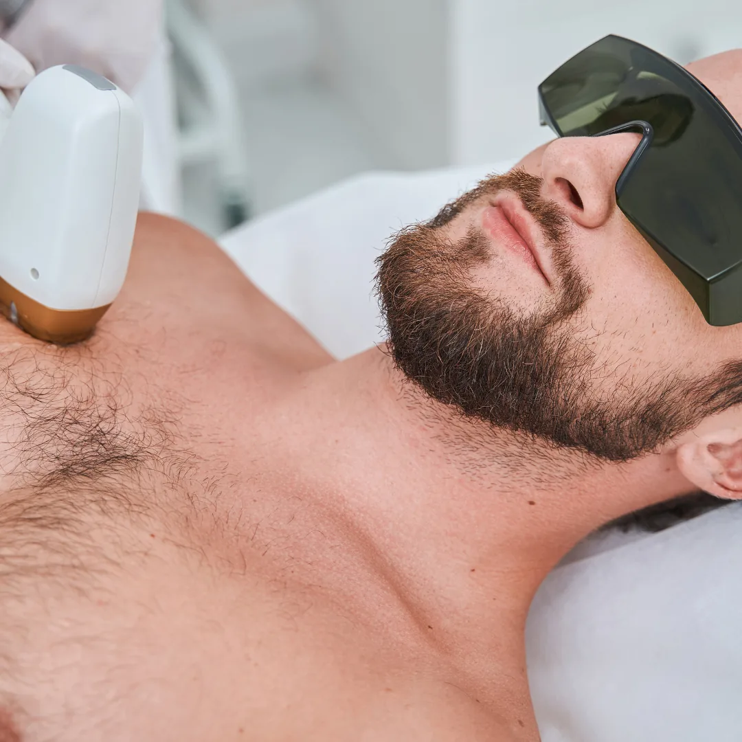 Client wearing protective glasses during laser hair removal on the chest